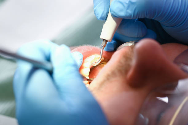 Best Emergency Dental Surgery in Juarez, TX